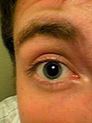 <b>Blind</b>