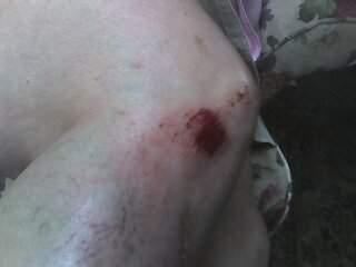 Ouch!