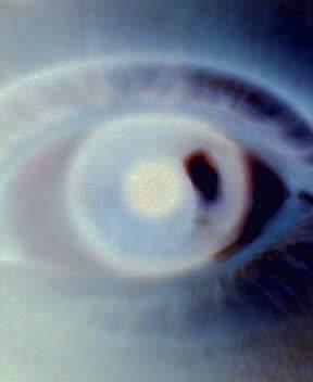 Eye Full