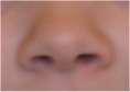 nose
