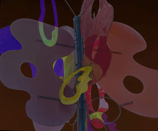 Sculpture by Impy Pilapil  (Modified by me)
