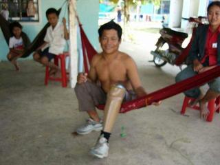 The Leg!!