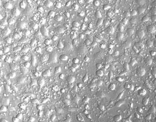 osteosarcoma cells
