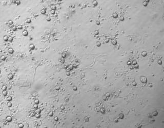 dying cells