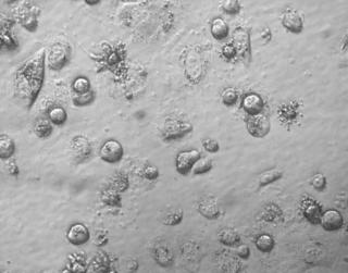 classic apoptosis