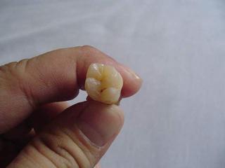 My Tooth