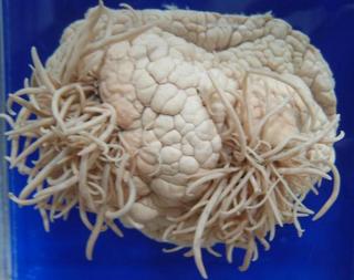 worms are eating the brain!